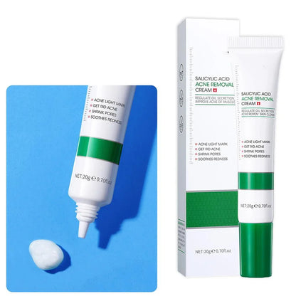 Salicylic Acid Acne Cream
